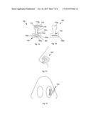 NOSE CLIP diagram and image