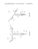 INTRAUTERINE CONTRACEPTIVE DEVICE diagram and image