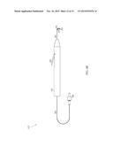 STEERABLE LASER PROBE diagram and image