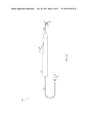 STEERABLE LASER PROBE diagram and image