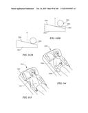 SYSTEMS, METHODS, AND DEVICES FOR TREATMENT OF SLEEP DISORDERS diagram and image