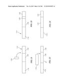 SYSTEMS, METHODS, AND DEVICES FOR TREATMENT OF SLEEP DISORDERS diagram and image