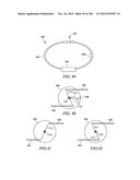 SYSTEMS, METHODS, AND DEVICES FOR TREATMENT OF SLEEP DISORDERS diagram and image