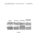 COMPOSITIONS AND METHODS FOR TREATING SKIN CANCER ASSOCIATED DISEASES diagram and image