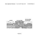 COMPOSITIONS AND METHODS FOR TREATING SKIN CANCER ASSOCIATED DISEASES diagram and image