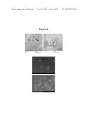 MAGNETIC NANOSTRUCTURES AS THERANOSTIC AGENTS diagram and image