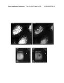 MAGNETIC NANOSTRUCTURES AS THERANOSTIC AGENTS diagram and image