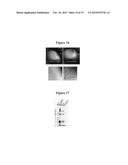 MAGNETIC NANOSTRUCTURES AS THERANOSTIC AGENTS diagram and image