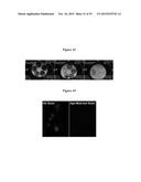 MAGNETIC NANOSTRUCTURES AS THERANOSTIC AGENTS diagram and image