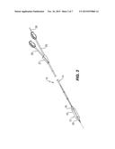 CATHETER WITH MARKINGS TO FACILITATE ALIGNMENT diagram and image