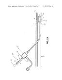 CATHETER WITH MARKINGS TO FACILITATE ALIGNMENT diagram and image