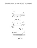RADIOPAQUE BALLOON CATHETER AND GUIDEWIRE TO FACILITATE ALIGNMENT diagram and image