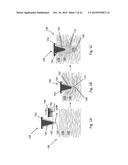 SWELLABLE ADHESIVE NEEDLES diagram and image