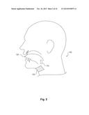 Electrode Configuration for Implantable Modulator diagram and image