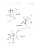 Electrode Configuration for Implantable Modulator diagram and image