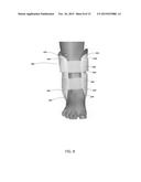 ALIGNMENT WRAP diagram and image