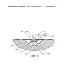 WOUND TREATMENT APPARATUS AND METHOD diagram and image