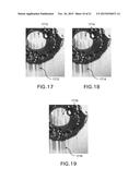 METHODS AND APPARATUS FOR LIPID MULTILAYER PATTERNING diagram and image