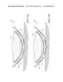 WHEEL AND TIRE ASSEMBLY diagram and image