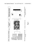 FURTHER USE OF PROTEIN KINASE N BETA diagram and image