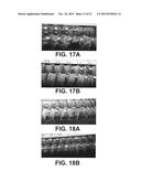 TURBULENT VACUUM THERMAL SEPARATION METHODS AND SYSTEMS diagram and image