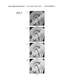 IMAGE PROCESSING APPARATUS, MAGNETIC RESONANCE IMAGING APPARATUS AND IMAGE     PROCESSING METHOD diagram and image