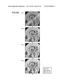 IMAGE PROCESSING APPARATUS, MAGNETIC RESONANCE IMAGING APPARATUS AND IMAGE     PROCESSING METHOD diagram and image