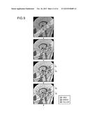 IMAGE PROCESSING APPARATUS, MAGNETIC RESONANCE IMAGING APPARATUS AND IMAGE     PROCESSING METHOD diagram and image