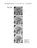 IMAGE PROCESSING APPARATUS, MAGNETIC RESONANCE IMAGING APPARATUS AND IMAGE     PROCESSING METHOD diagram and image