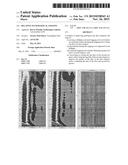 RELATING TO GEOLOGICAL LOGGING diagram and image