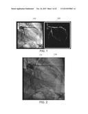 CREATING A VASCULAR TREE MODEL diagram and image