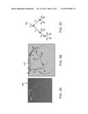 CREATING A VASCULAR TREE MODEL diagram and image