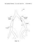 CREATING A VASCULAR TREE MODEL diagram and image