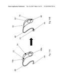 HEARING DEVICE diagram and image