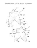 Baby Handling Device diagram and image