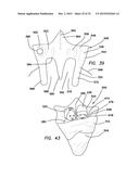 Baby Handling Device diagram and image