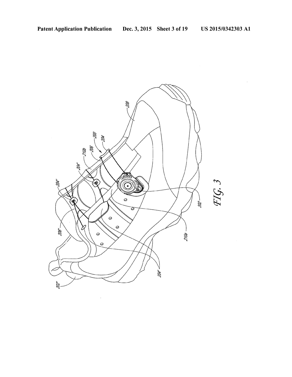 REEL-BASED LACING SYSTEM - diagram, schematic, and image 04