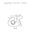 VIEW OPTIMIZER AND STABILIZER FOR USE WITH SURGICAL SCOPES diagram and image