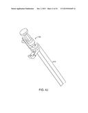 VIEW OPTIMIZER AND STABILIZER FOR USE WITH SURGICAL SCOPES diagram and image