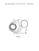 VIEW OPTIMIZER AND STABILIZER FOR USE WITH SURGICAL SCOPES diagram and image