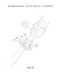 VIEW OPTIMIZER AND STABILIZER FOR USE WITH SURGICAL SCOPES diagram and image