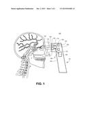 SYSTEM FOR NON-INVASIVE MEASUREMENT OF INTRACRANIAL PRESSURE AND     ASSOCIATED METHODS diagram and image