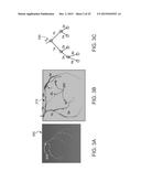 CALCULATING A FRACTIONAL FLOW RESERVE diagram and image