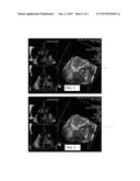 Transparency control for medical diagnostic ultrasound flow imaging diagram and image