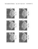 Devices, Systems, and Methods for Controlling Field of View in Imaging     Systems diagram and image