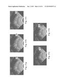 Devices, Systems, and Methods for Controlling Field of View in Imaging     Systems diagram and image