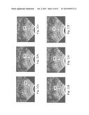 Devices, Systems, and Methods for Controlling Field of View in Imaging     Systems diagram and image