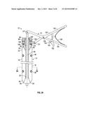 DILATION SYSTEM diagram and image