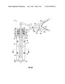 DILATION SYSTEM diagram and image