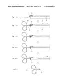 WIRE KNOT DELIVERY DEVICE diagram and image